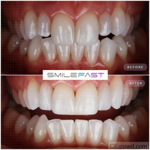 Smilefast Direct Training