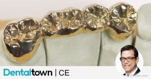 Aesthetic Conservative Cast Gold Restorations by Dr. Richard G. Stevenson III