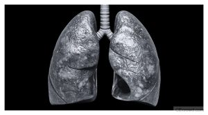 Airway Issues in Dentistry