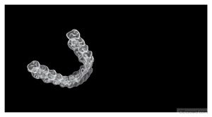 Biomechanics of Clear Aligner Treatments