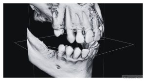 CBCT Protocols Simplified