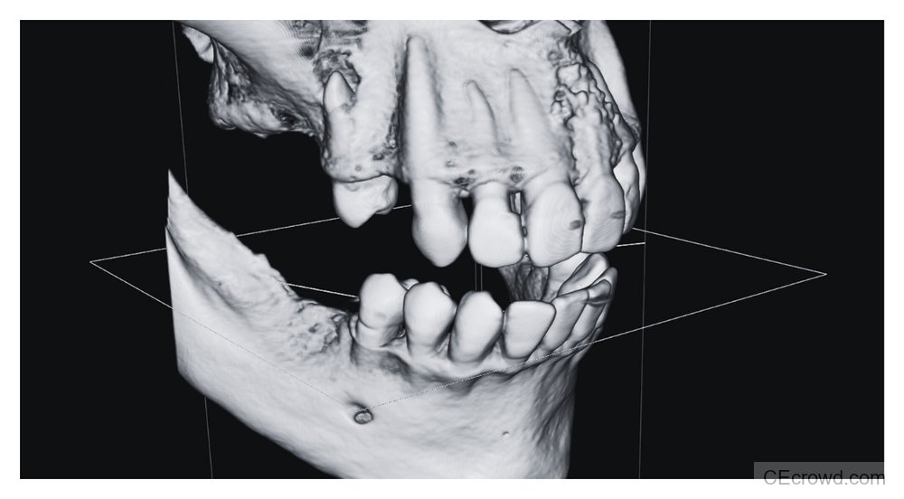CBCT Protocols Simplified