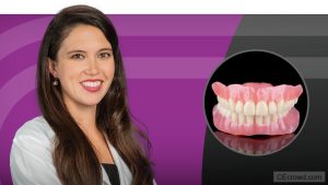 Complete Dentures: Introduction to Removable Prostheses