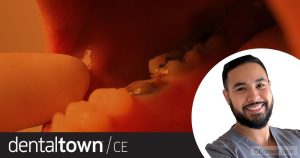 Know How To Manage Dental Traumas by Dr. Badr Hefnawi