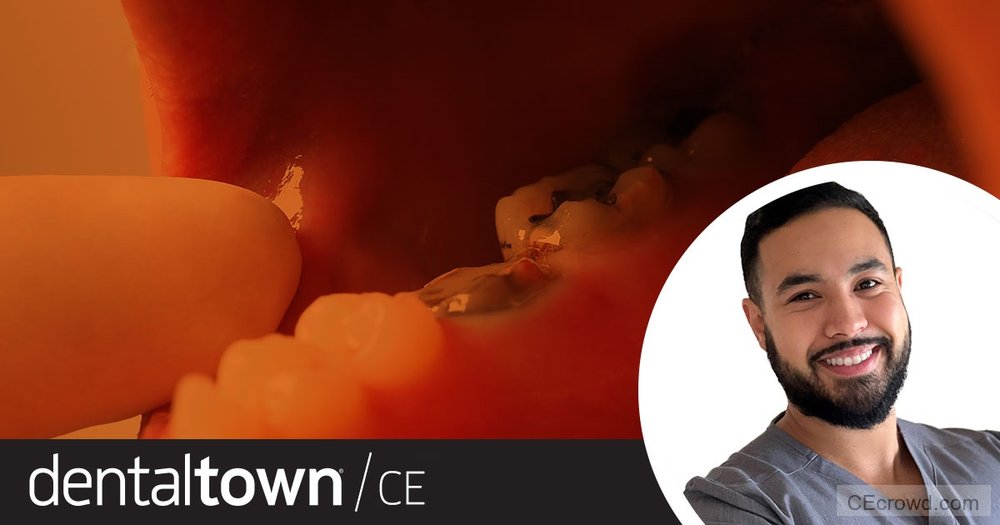 Know How To Manage Dental Traumas by Dr. Badr Hefnawi
