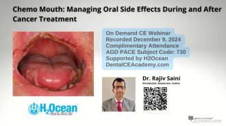 Managing Oral Side Effects During and After Cancer Treatment