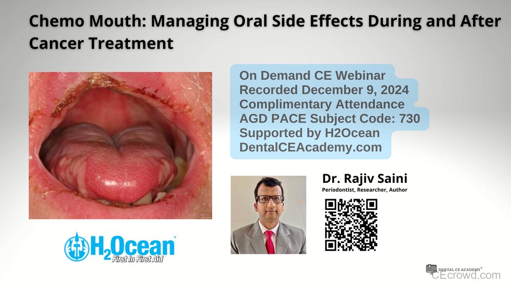 Managing Oral Side Effects During and After Cancer Treatment