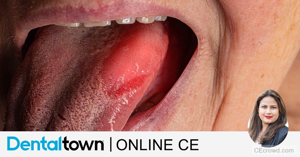 Oral Cancer: A Journey of Cancer, Grief and Finding a Purpose by Dr. Parul Dua Makkar