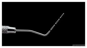Periodontal Diagnosis & Treatment