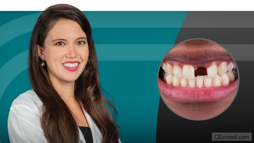 Treatment Planning for Single-Unit Implant Placement