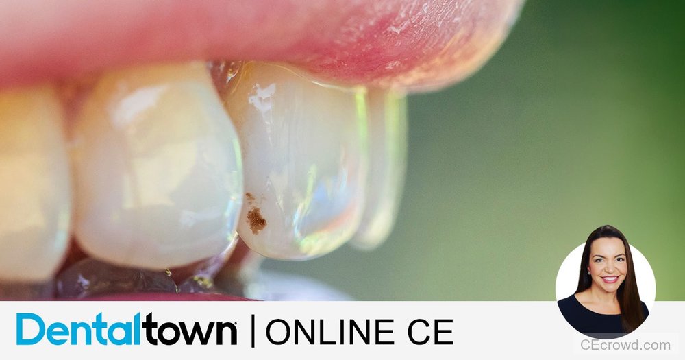 White Spot, What Now? An Update on Incipient Caries Treatments by Dr. Jeanette MacLean